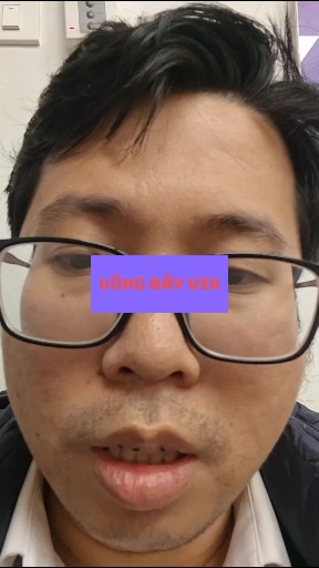 Vùng đáy cổ phiếu vix