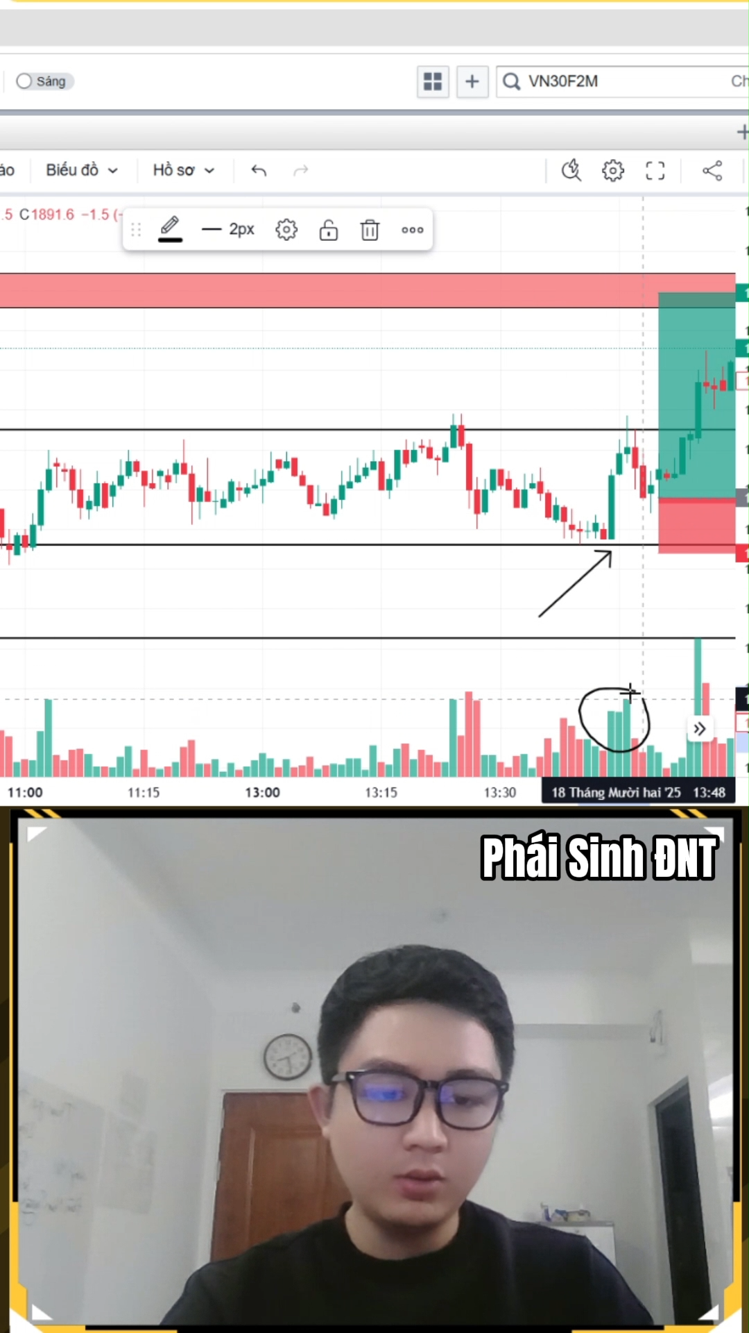 Cách cài Stop Loss - TP giúp tối ưu lợi nhuận